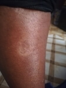 1579889194 82 lr tattoo clinic 1